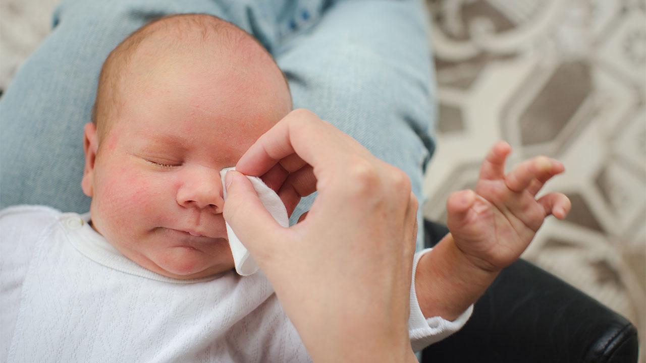 Zašto su bebi oči ljepljive i suzne