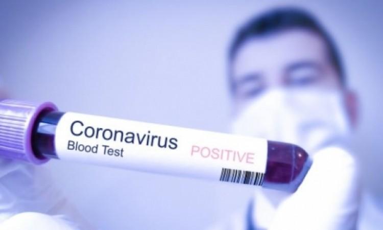 Today 13 new cases of coronavirus infection were registered in the Brčko District of B&H - Avaz