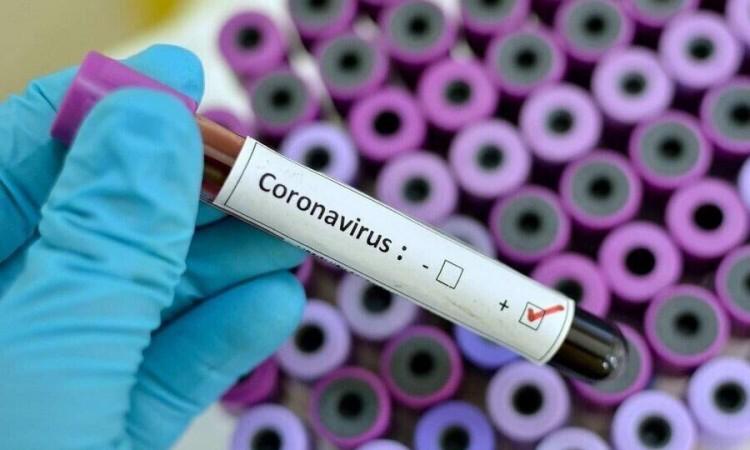 B&H registers 1,738 new cases of coronavirus, 57 persons died