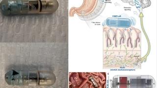 Je li pilula koja vibrira u želucu revolucija u borbi s viškom kilograma